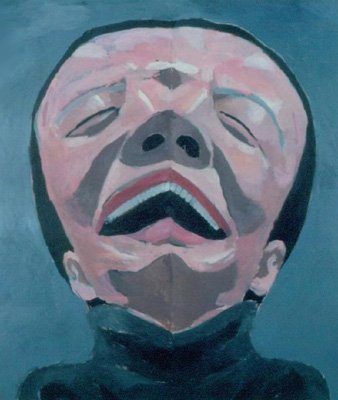 Yue Minjun Symmetry II